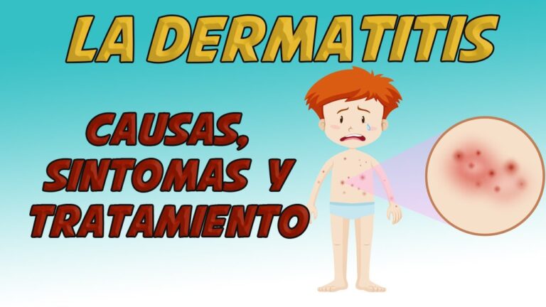 ¿Tienes Sarna o Dermatitis? Aprende a Identificar los Síntomas Clave